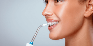 Cuántas veces usar un irrigador dental